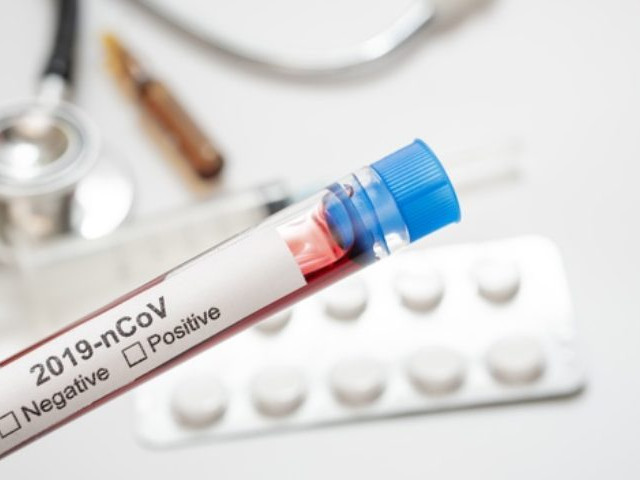 Ми відтерміновуємо щорічний Відпочинок для осіб з фізичними вадами "Єдність"